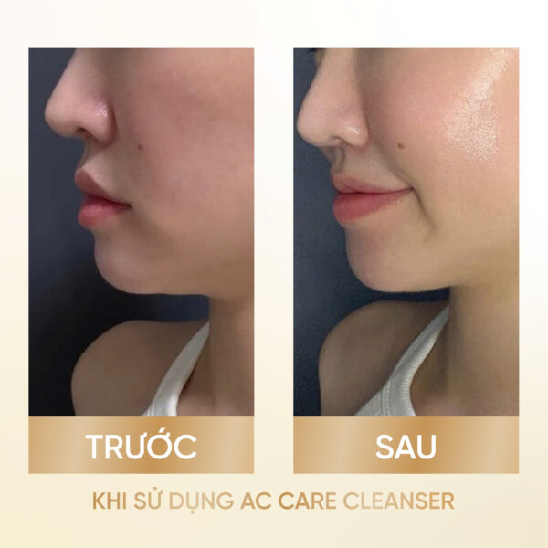 MOUSSE NETTOYANTE d'AURORA<br> <span style="color:#C8985A;">Sữa rửa mặt (100ml)</span> - Hình ảnh 5