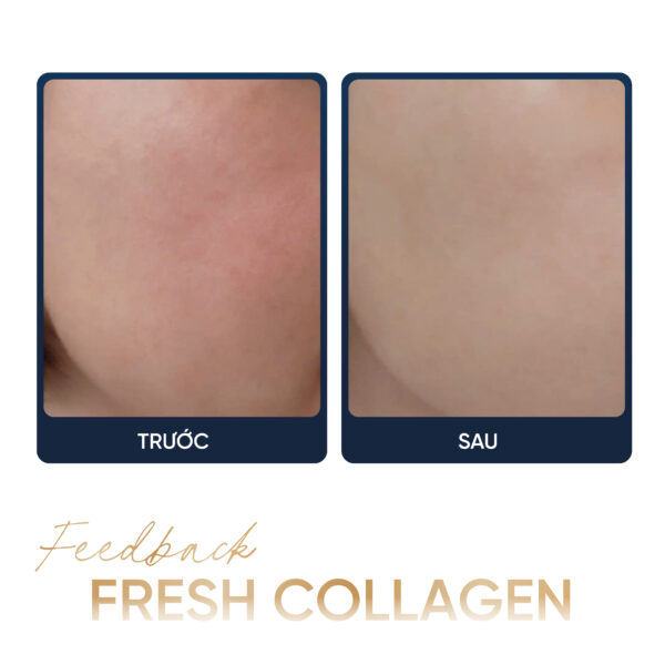 AMPOULE de COLLAGÈNE<br> <span style="color:#C8985A;">Tinh chất Collagen (35ml)</span> - Hình ảnh 5