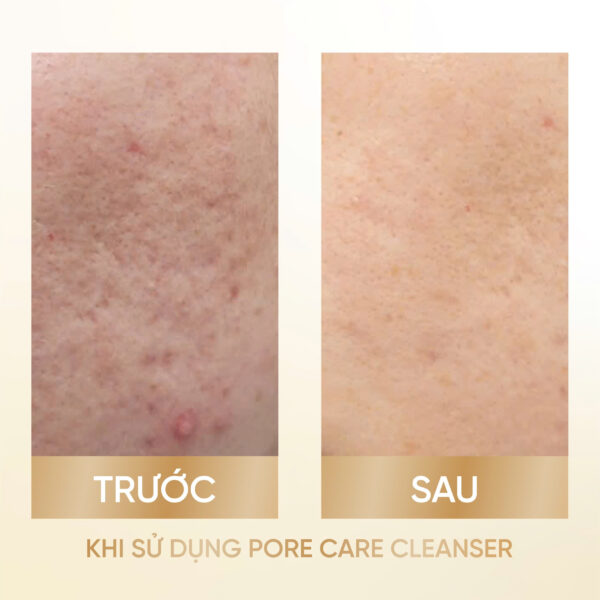 MOUSSE NETTOYANTE de STELLA<br> <span style="color:#C8985A;">Sữa rửa mặt (100ml)</span> - Hình ảnh 5