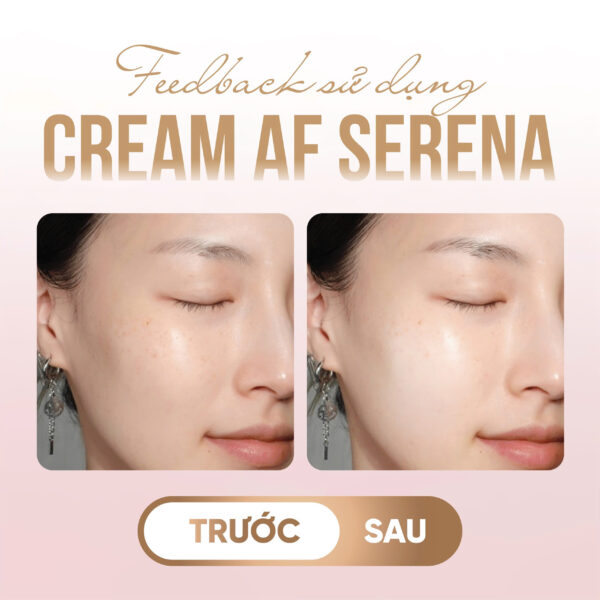 Kem Dưỡng Mờ Thâm Nám, Tàn Nhang, Không Đều Màu Da Melanin Care Cream 30ml - Hình ảnh 6