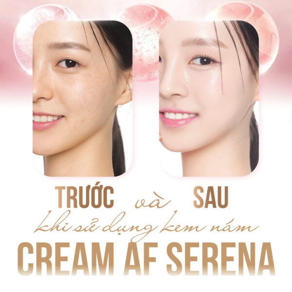 Kem Dưỡng Mờ Thâm Nám, Tàn Nhang, Không Đều Màu Da Melanin Care Cream 30ml - Hình ảnh 9