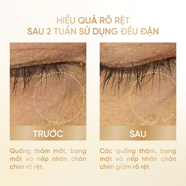 CRÈME CONTOUR des YEUX MEMORIA<br> <span style="color:#C8985A;">Kem mắt (25ml)</span> - Hình ảnh 7